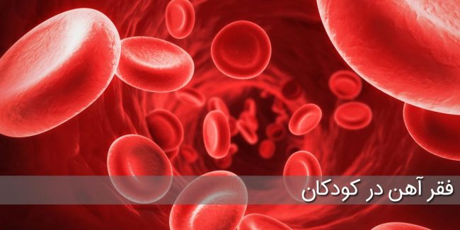 کمبود آهن در کودک